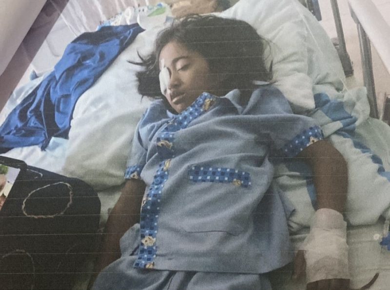 Alesha, Anak 7 Tahun Asal Karimun yang Berjuang Melawan Kanker Otak. Foto: Istimewa